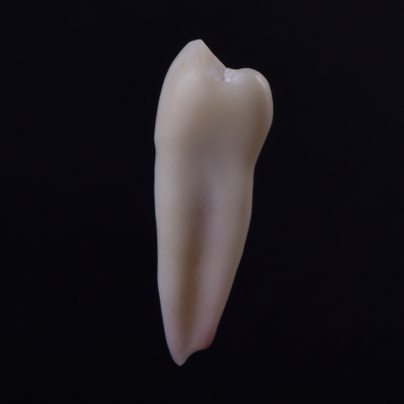 Upper first premolar single root Radiopaque