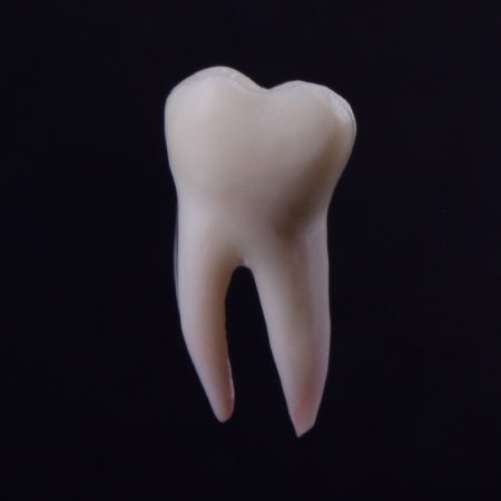 Lower first molar Radiopaque