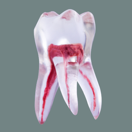 Upper first molar Transparent