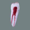 Upper first premolar single root Transparent