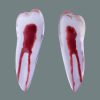 Upper first premolar single root Transparent